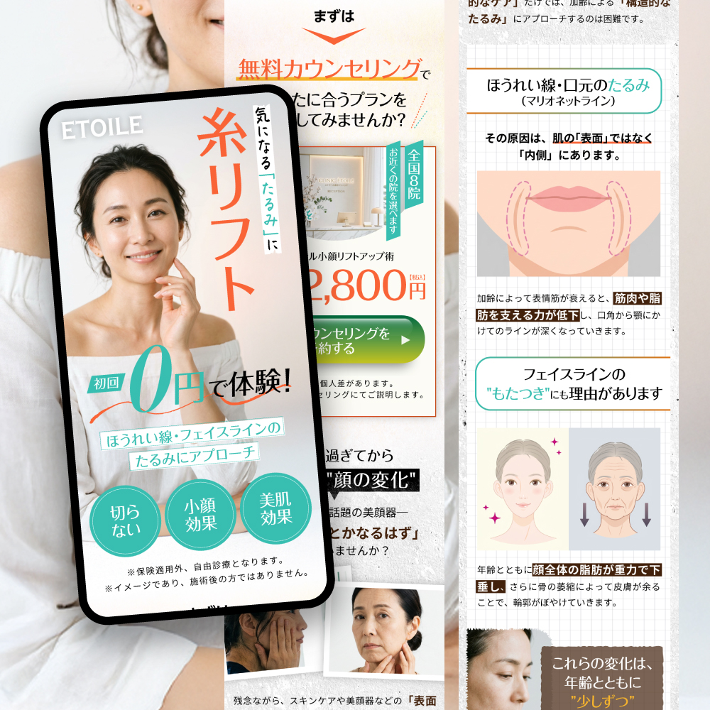 糸リフトLP