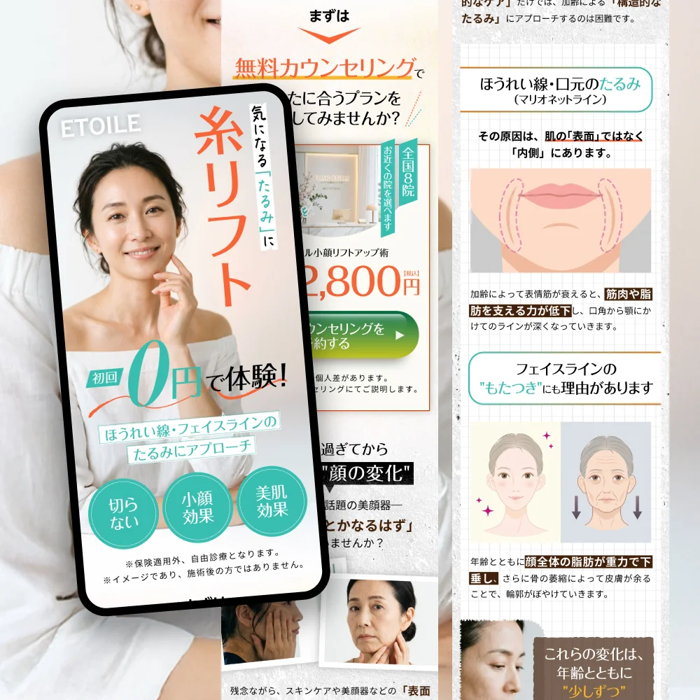 糸リフトLP