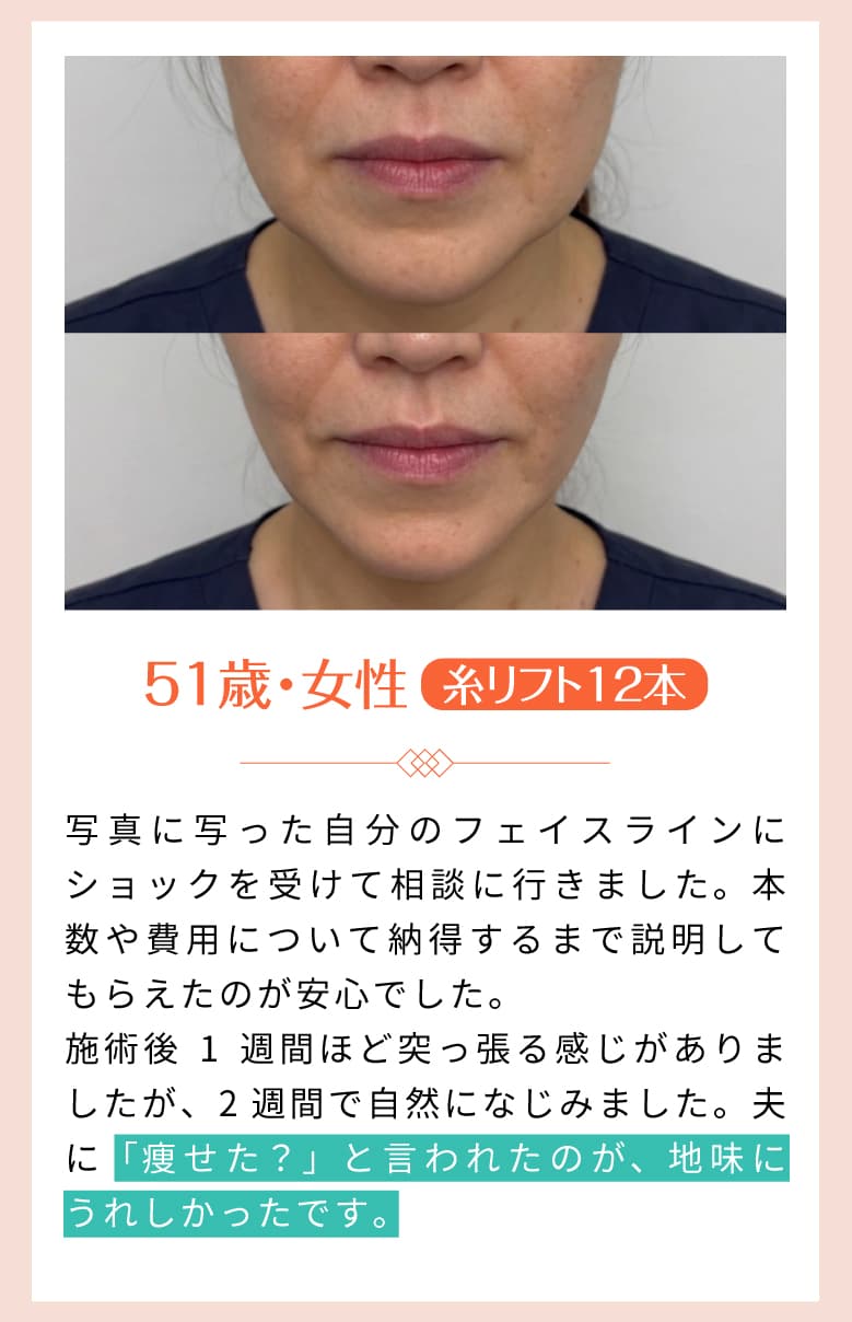 施術の特長