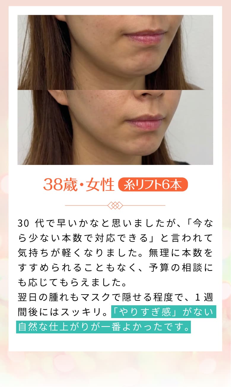 施術の流れ